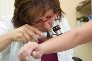 melanom-lekar-vysetrenie-veresova